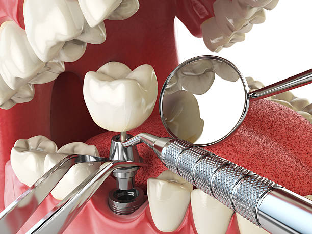 Best Knocked-Out Tooth Emergency  in Winfield, WV